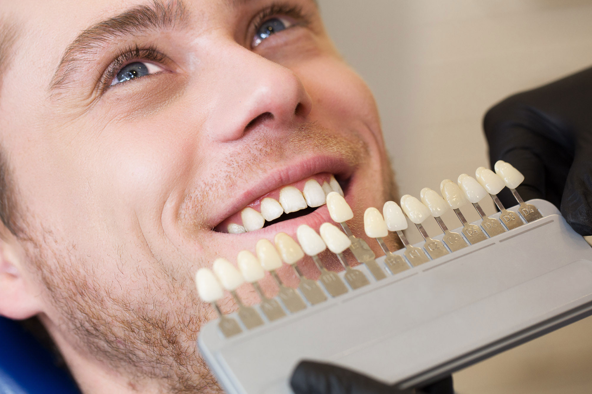 man receiving porcelain veneers options